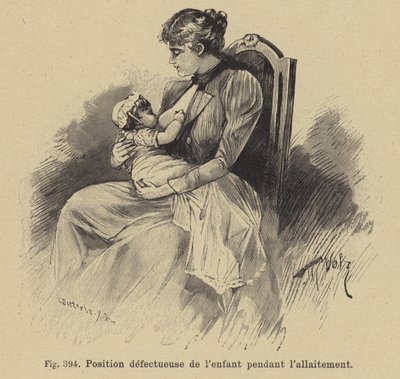 Falsche Position eines Babys beim Stillen von German School