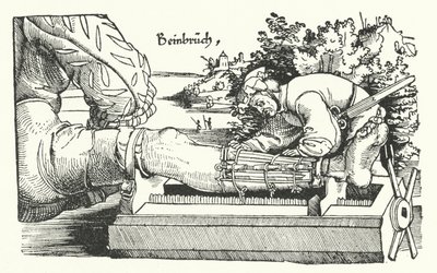 Behandlung eines gebrochenen Beins von German School