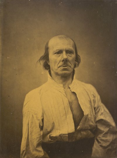 Gesicht in Ruhe, 1854-1856, gedruckt 1862 von Guillaume-Benjamin-Armand Duchenne de Boulogne