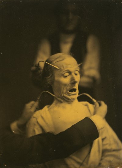Ausdruck des Schreckens von Guillaume Benjamin Amant Duchenne