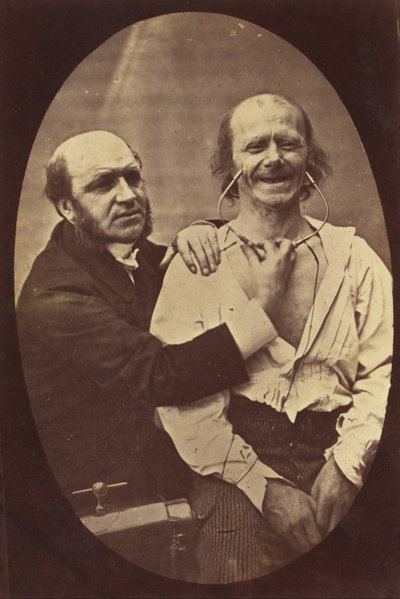 Mechanismus der menschlichen Physiognomie oder elektro-physiologische Analyse des Ausdrucks der Leidenschaften von Guillaume Benjamin Duchenne