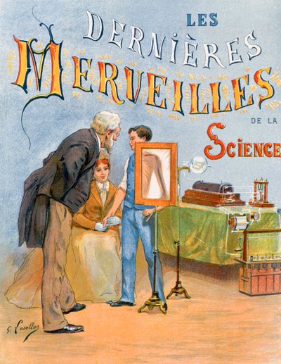 Die Untersuchung eines Kinderarms durch Radiographie, 19. Jahrhundert von Gustave Francois Lasellaz