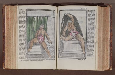 Weibliche Anatomie, aus Commentaria cum amplissimis additionibus super anatomiam mundini, von Jacopo Berengario da Carpi (ca. 1460-ca. 1530) veröffentlicht in Bologna, 1521 (Farbholzschnitt) von Italian School