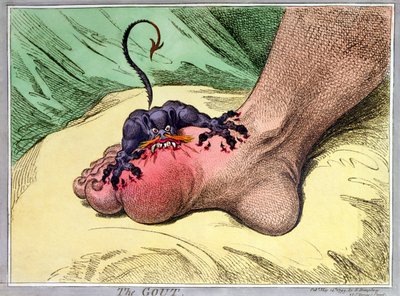 Die Gicht, veröffentlicht von Hannah Humphrey 1799 von James Gillray