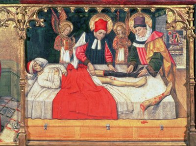 SS. Cosmas und Damian transplantieren das Bein eines Äthiopiers auf den Stumpf des Diakons Justinian von Jaume Huguet