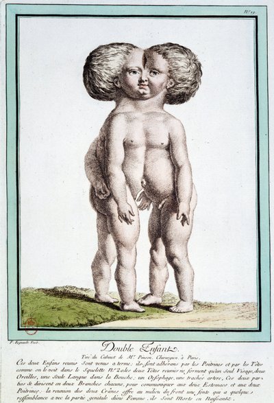 Siamesische Kinder - in „Les deviations de la nature“ von Régnault von Jean Baptiste Regnault