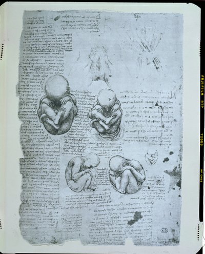 Fünf Ansichten eines Fötus im Mutterleib, Faksimilekopie von Leonardo da Vinci