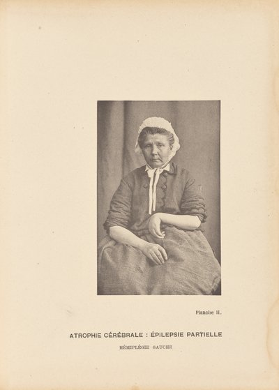 Zerebrale Atrophie: Partielle Epilepsie, linke Hemiplegie von Paul Marie Léon Regnard