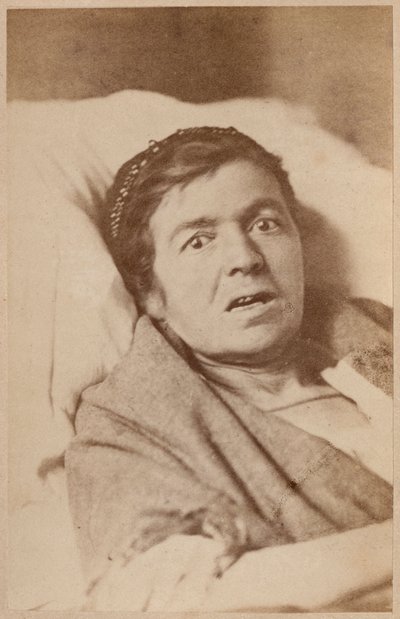 Hysterische Epilepsie, Gesichtskontraktion, Platte VIII aus 