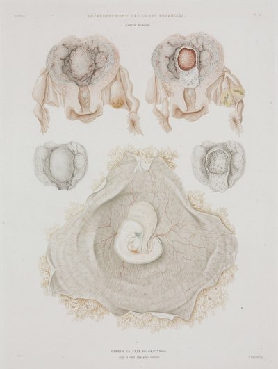 Gynäkologie: Menschliche Gebärmutter mit Embryo, ca. 1847-1859 von John Pardon