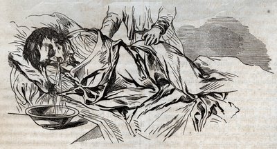 Unfallmedizin - über die wirksamste Hilfe für Ertrunkene - die Walnusswindeln auf der Seite und das Erbrechen des getrunkenen Wassers - Gravur in „La Santé Universelle - Guide Médical des Familles“ 1852 von Unknown artist