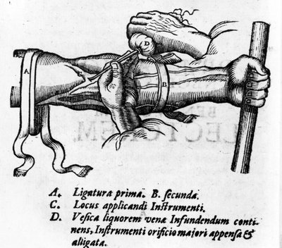 Anatomische Tafel: verschiedene Ligaturen. Arbeit über das Blutsystem von William Harvey (1578-1657), englischer Arzt. Er beschrieb den Blutkreislauf im Körper durch die Vermittlung der Venen von Unknown artist