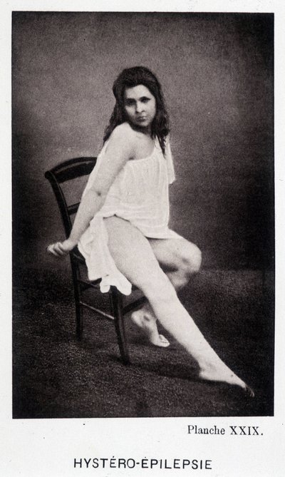 Hystero Epilepsie - Kontraktur in „Photographische Ikonographie der Salpêtrière: Dienst von Herrn Charcot“ von Paul Regnard und Bourneville von Unknown artist
