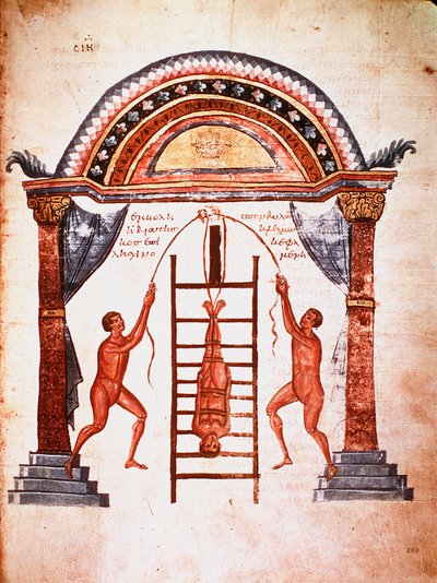 Medizin: Reduktion einer ausgerenkten Wirbelsäule, der Patient wird mit Gurten an eine Leiter gehängt (Manuskript) von Unknown artist