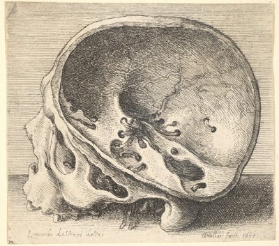 Profil eines geschnittenen Schädels nach links mit entferntem linken Schädelteil, 1651 von Wenceslaus Hollar