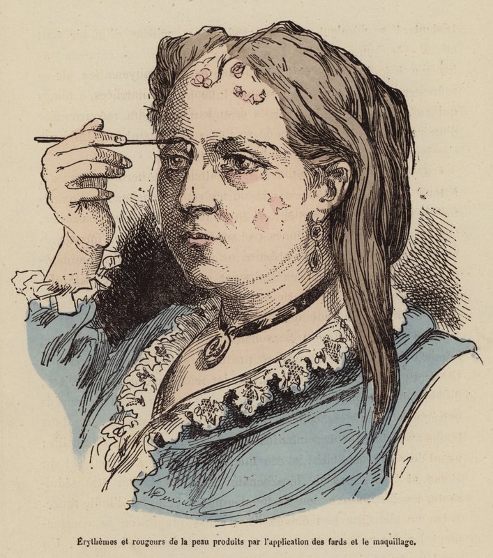 Frau mit Hautausschlägen und Rötungen durch die Verwendung von Make-up von (after) French School