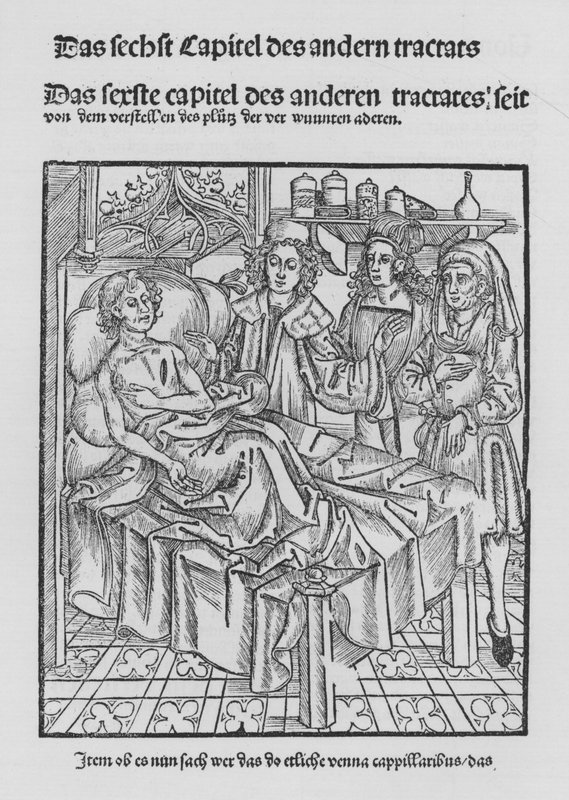 Das Buch der Chirurgie von Hieronymus Brunschwig von (after) German School