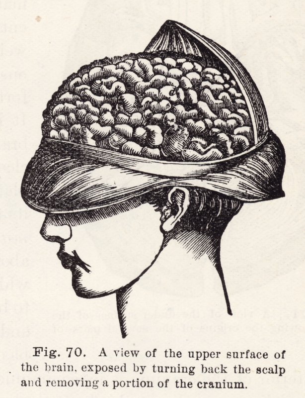 Ansicht der oberen Oberfläche des Gehirns, freigelegt durch Zurückziehen der Kopfhaut und Entfernen eines Teils des Schädels (Stich) von English School