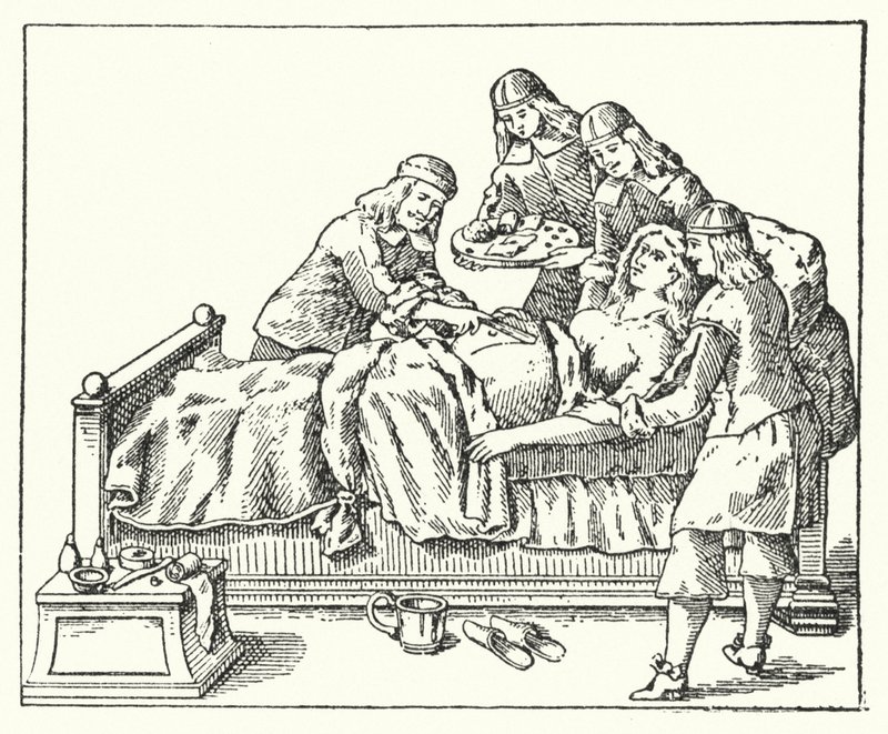 Ein Kaiserschnitt im 17. Jahrhundert von European School