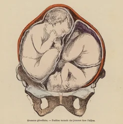 Normale Position von Zwillingen im Mutterleib während der Schwangerschaft