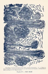 Die Haut (Farblithografie)