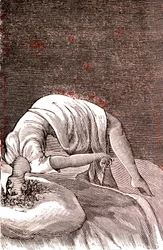 Hysterie, geistige und nervöse Störung, verursacht durch intensive Angst. 1887