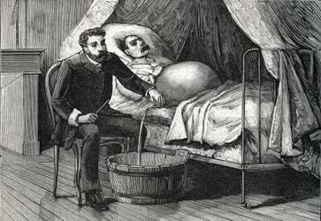 Patient mit fortgeschrittener Leberzirrhose, Arzt führt eine Punktion durch (Gravur) 1888