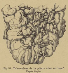 Rindertuberkulose