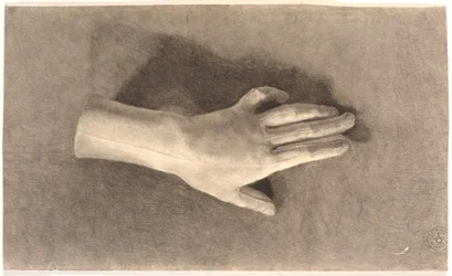 Studie einer Gips-Hand