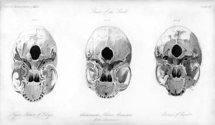 Basis des Schädels, 1848