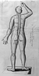 De Acupunctura von W. Ten Rhijne. London 1683. Erster westlicher Text über Akupunktur