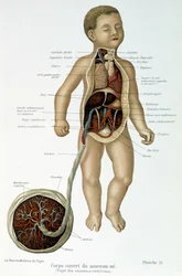 Medizin: Neugeborenes (im Brustbereich gehäutet)
